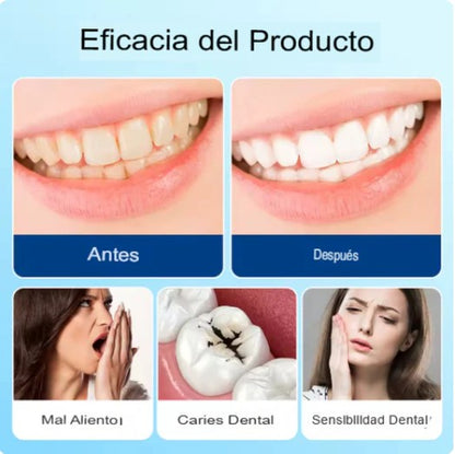 ARMADURA DENTAL CON HIDROXIAPATITA